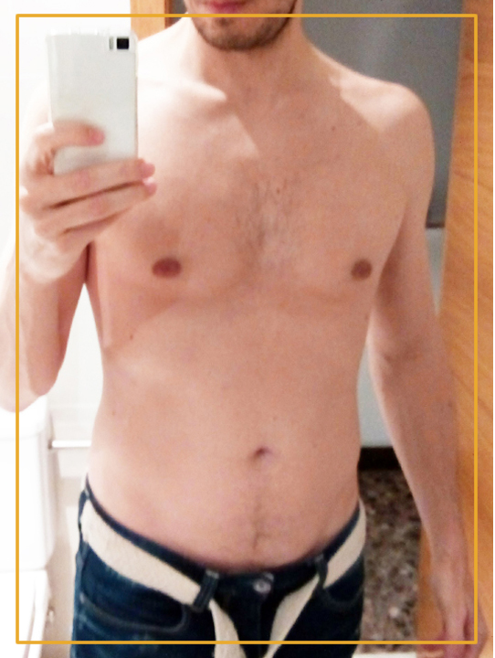 Antes